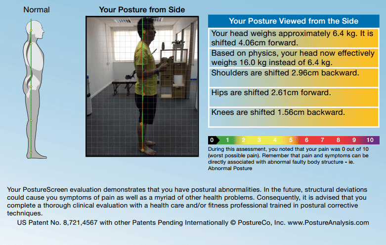 Forward head posture alignment and normal body alignments