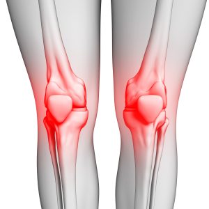 Symptoms of Serious Knee Pain