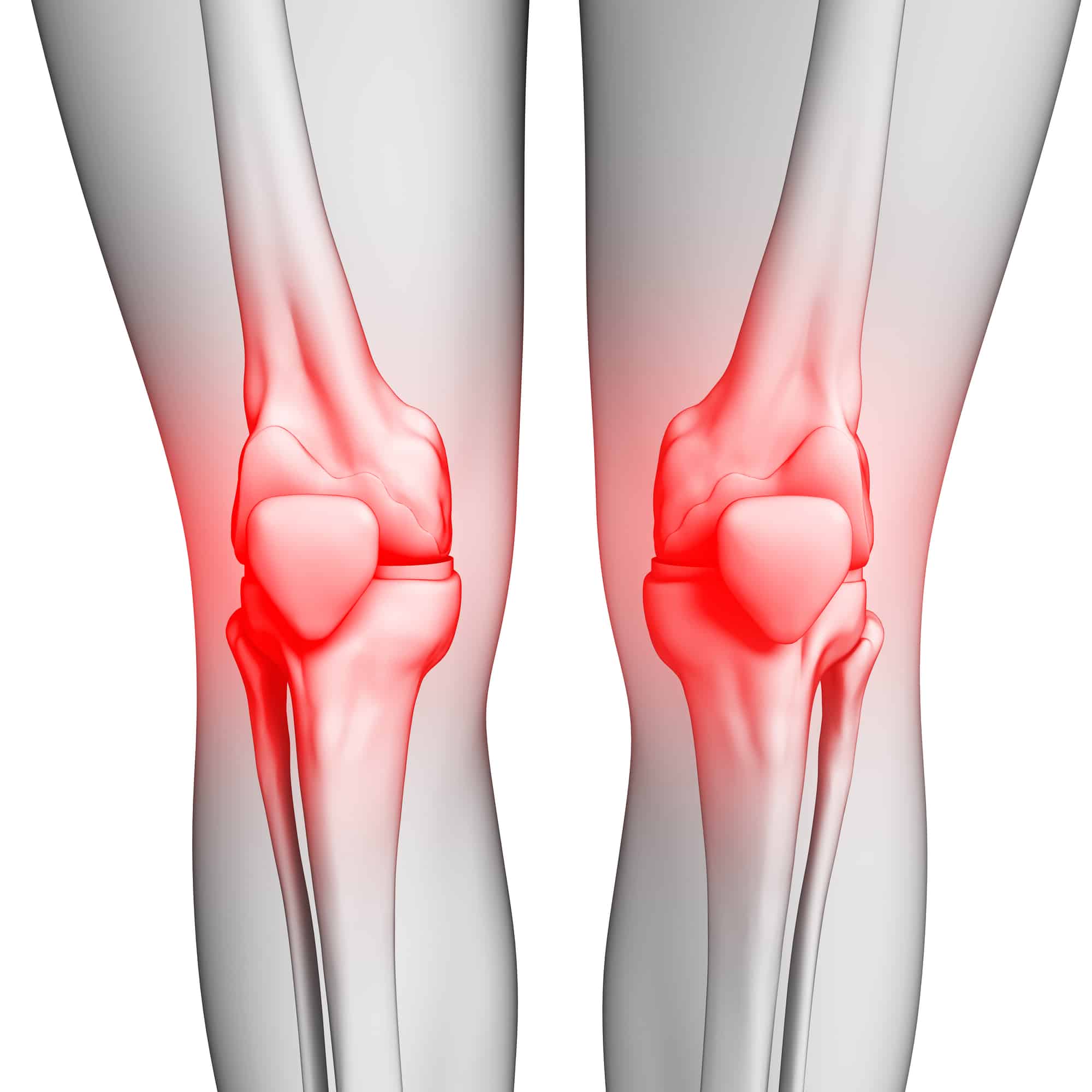 Symptoms of Serious Knee Pain