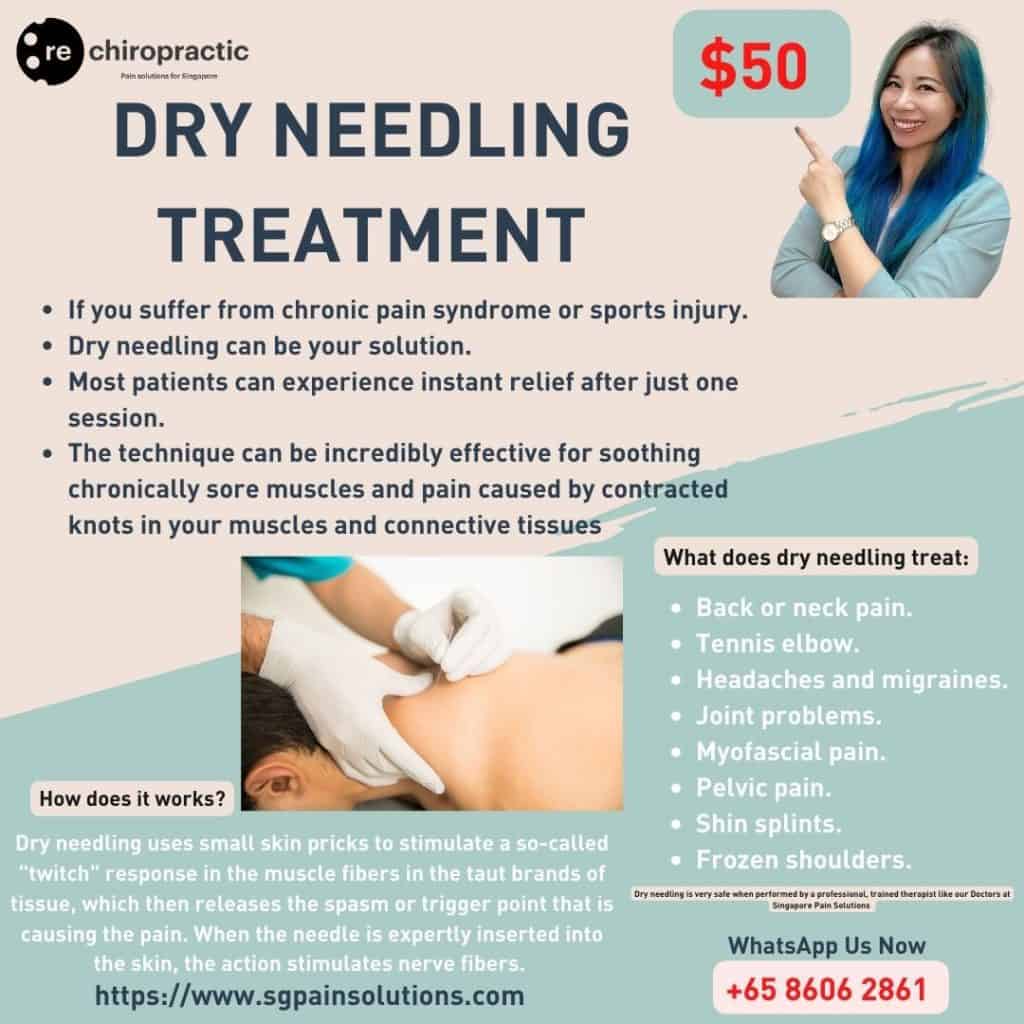 dry needling