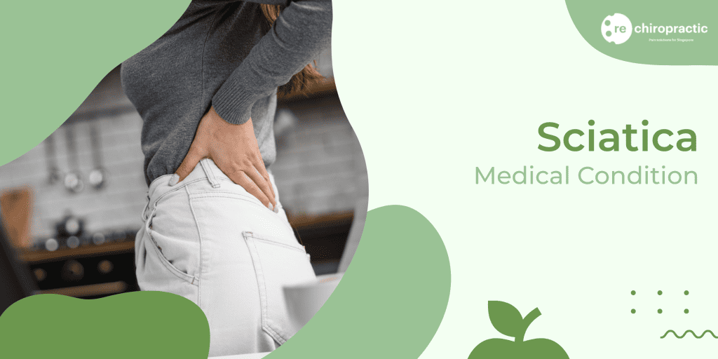 Sciatica Pain: Causes, Symptoms, Self-Help & Chiropractic Treatments